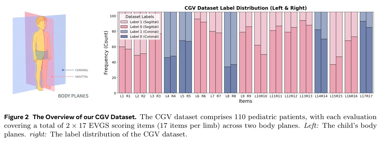 The Overview of our CGV Dataset
