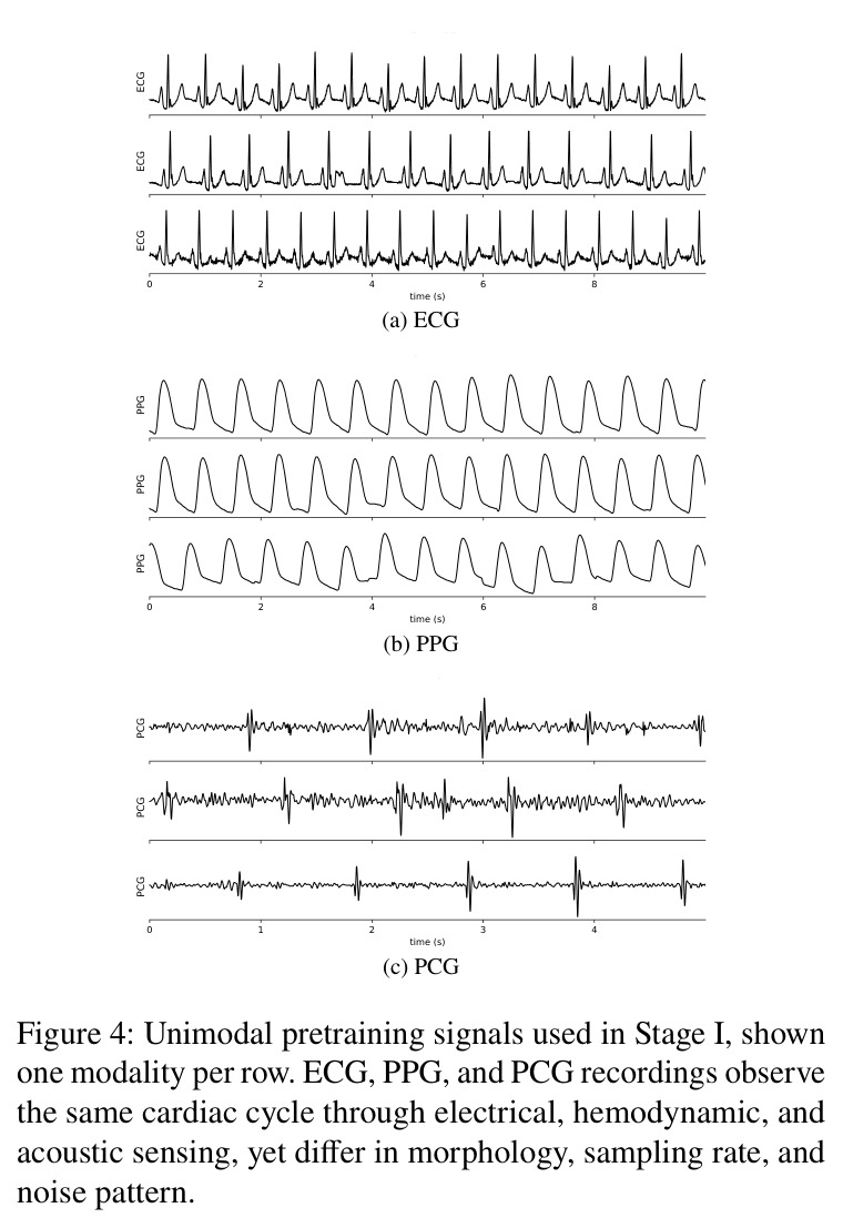 Unimodal pretraining signals used in Stage I, shown one modality per row. ECG, PPG, and PCG recordings observe the same cardiac cycle through electrical, hemodynamic, and acoustic sensing, yet differ in morphology, sampling rate, and noise pattern.