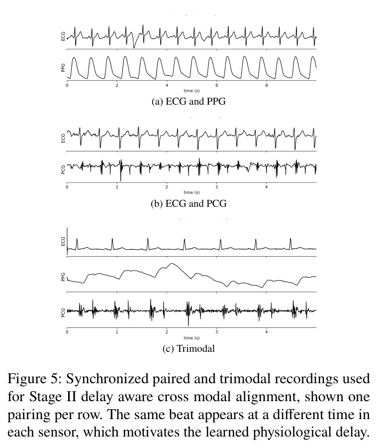 Synchronized paired and trimodal recordings used for Stage II delay aware cross modal alignment, shown one pairing per row. The same beat appears at a different time in each sensor, which motivates the learned physiological delay.