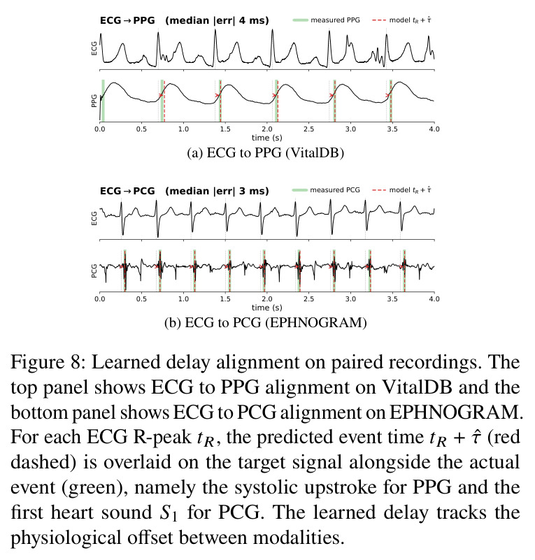 Learned delay alignment on paired recordings. The top panel shows ECG to PPG alignment on VitalDB and the bottom panel shows ECG to PCG alignment on EPHNOGRAM.