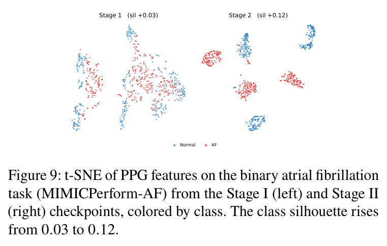 t-SNE of PPG features on the binary atrial fibrillation task (MIMICPerform-AF) from the Stage I (left) and Stage II (right) checkpoints, colored by class. The class silhouette rises from 0.03 to 0.12.