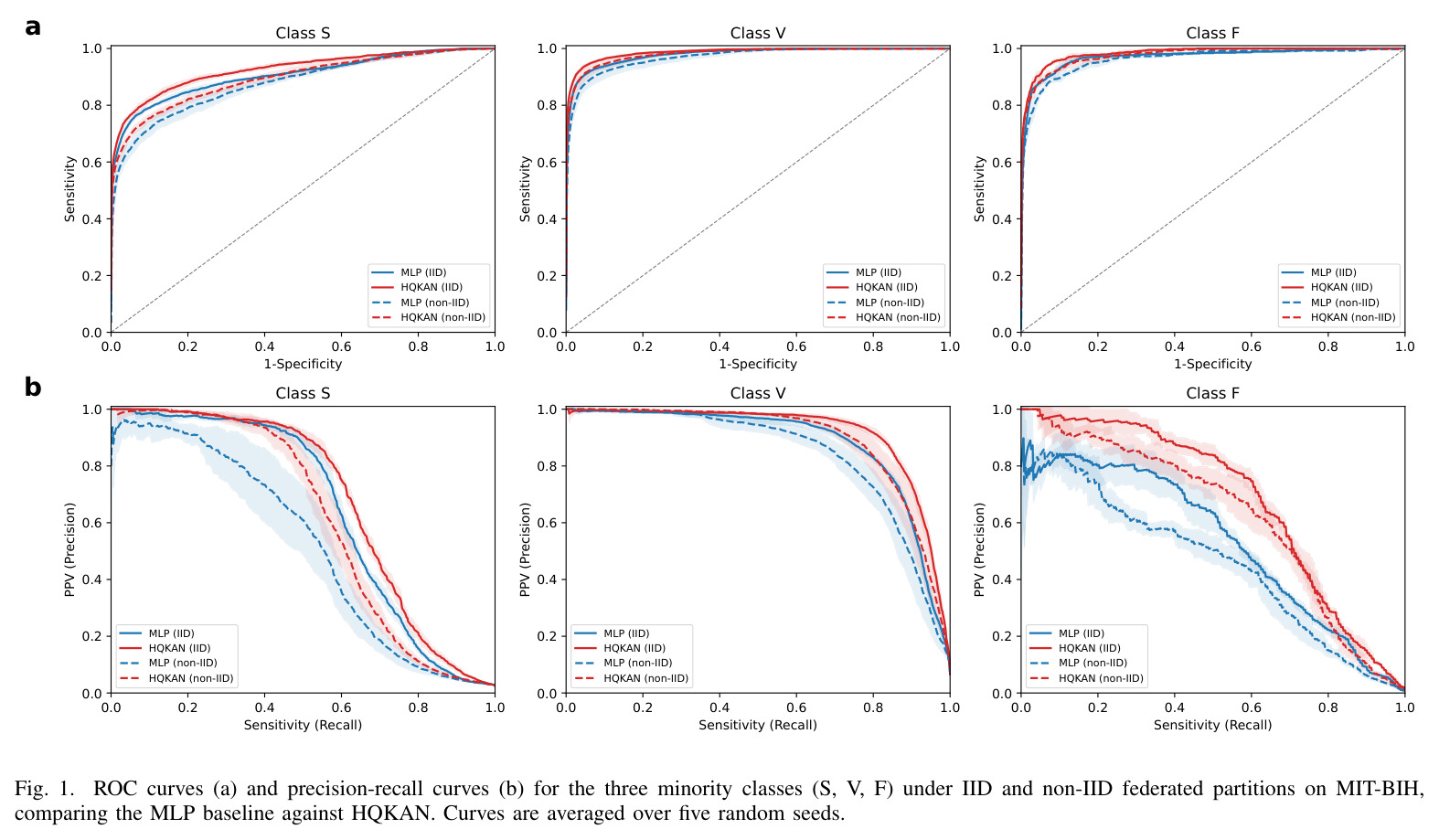 ROC curves (a) and precision-recall curves (b) for the three minority classes (S, V, F) under IID and non-IID federated partitions on MIT-BIH, comparing the MLP baseline against HQKAN. Curves are averaged over five random seeds.