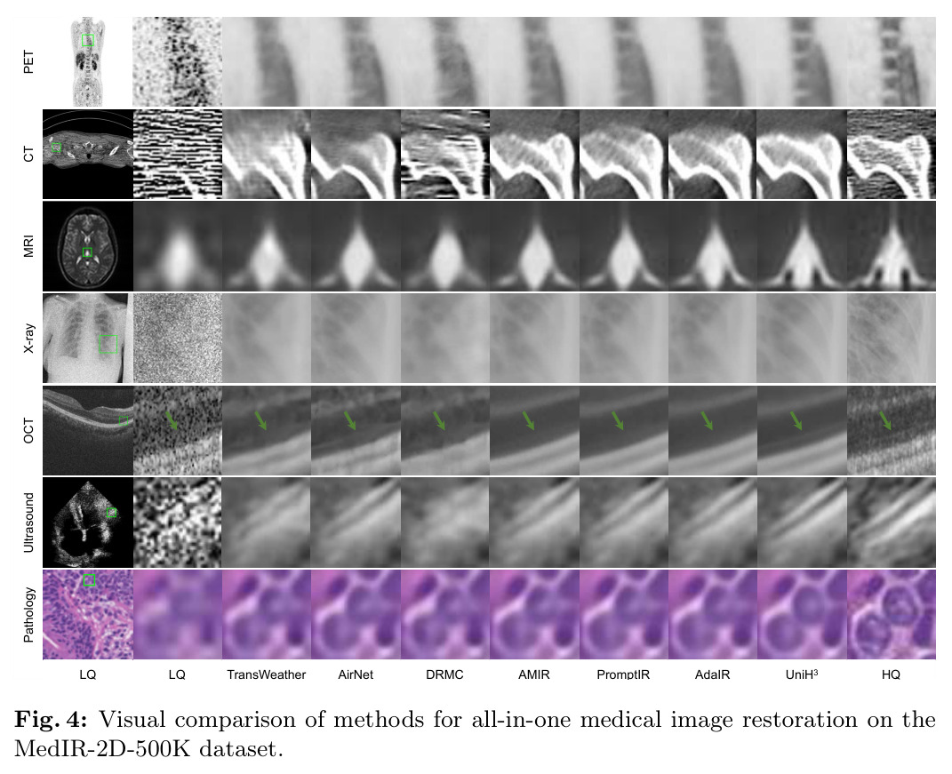 Visual comparison of methods for all-in-one medical image restoration on the MedIR-2D-500K dataset.