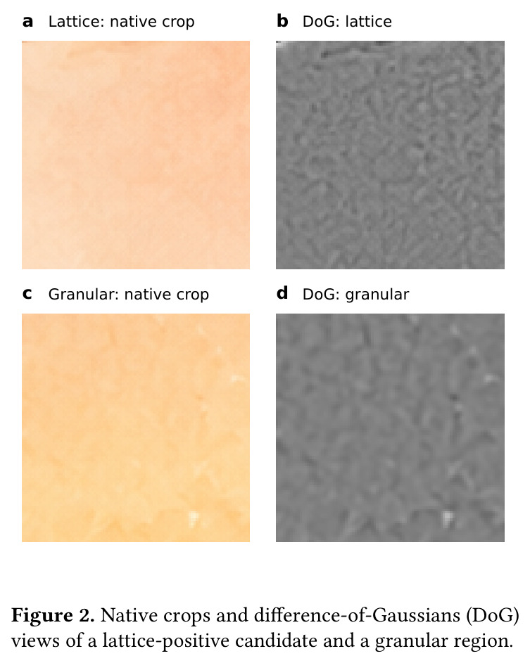 Native crops and difference-of-Gaussians (DoG) views of a lattice-positive candidate and a granular region.